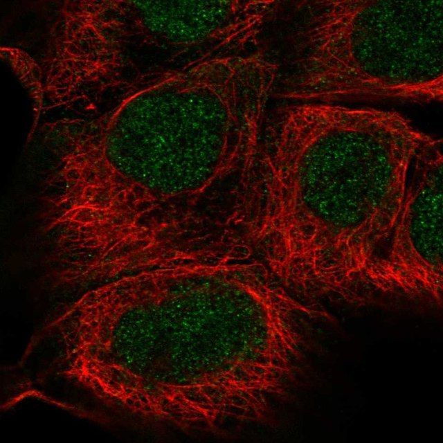 Anti-SGPP1 antibody produced in rabbit