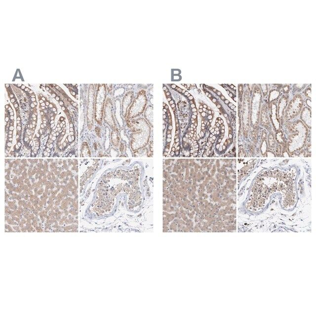 Anti-SGPL1 antibody produced in rabbit