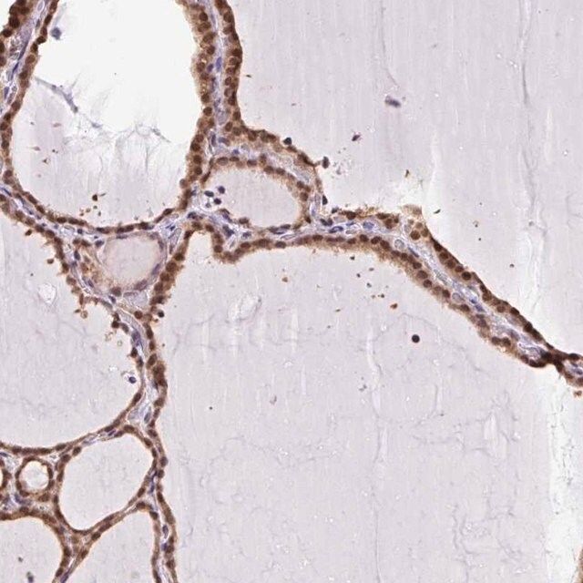 Anti-SGTA antibody produced in rabbit