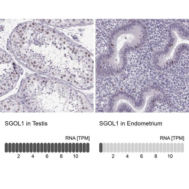 Anti-SGO1 antibody produced in rabbit