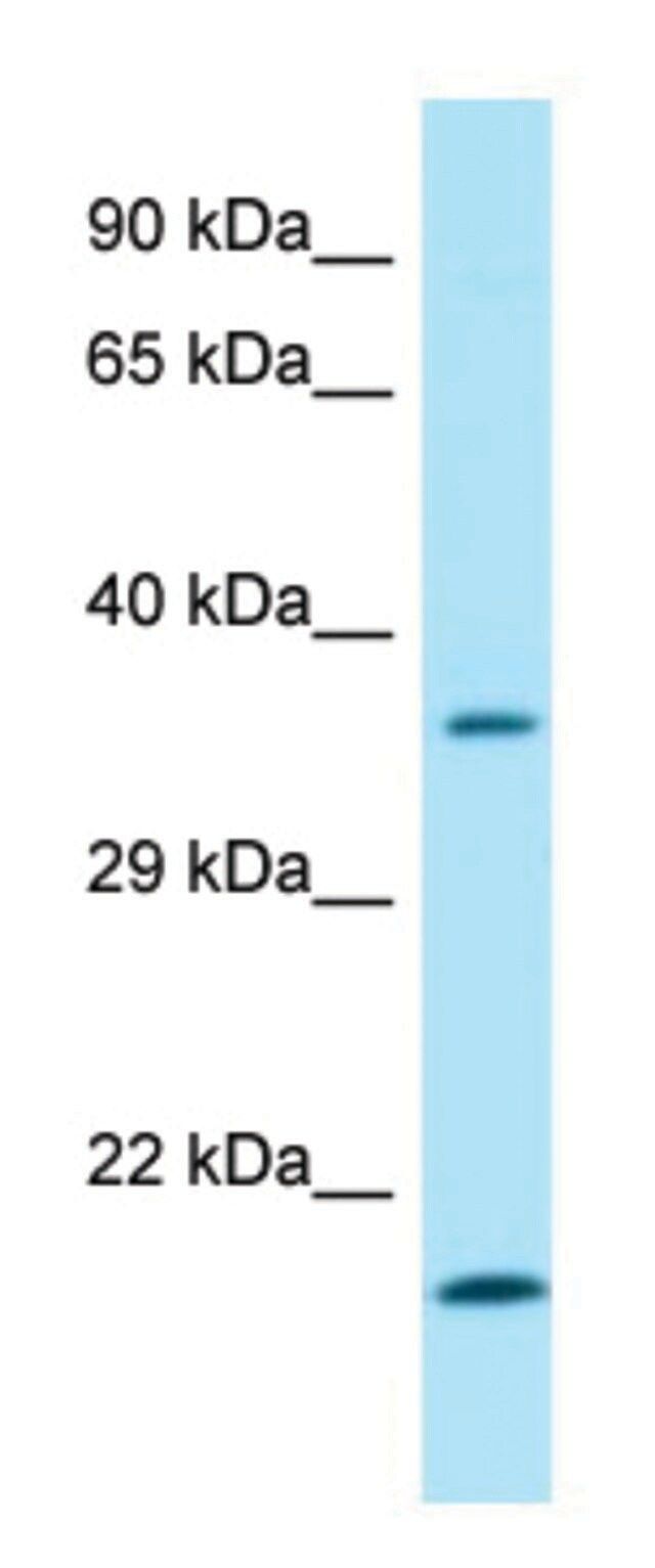 Anti-SGTA (C-terminal) antibody produced in rabbit