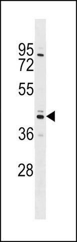 ANTI-SHBG (N-TERM) antibody produced in rabbit