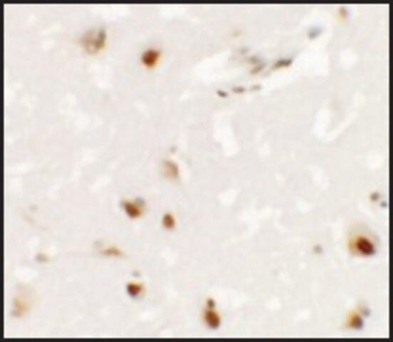 Anti-SHANK3 antibody produced in rabbit