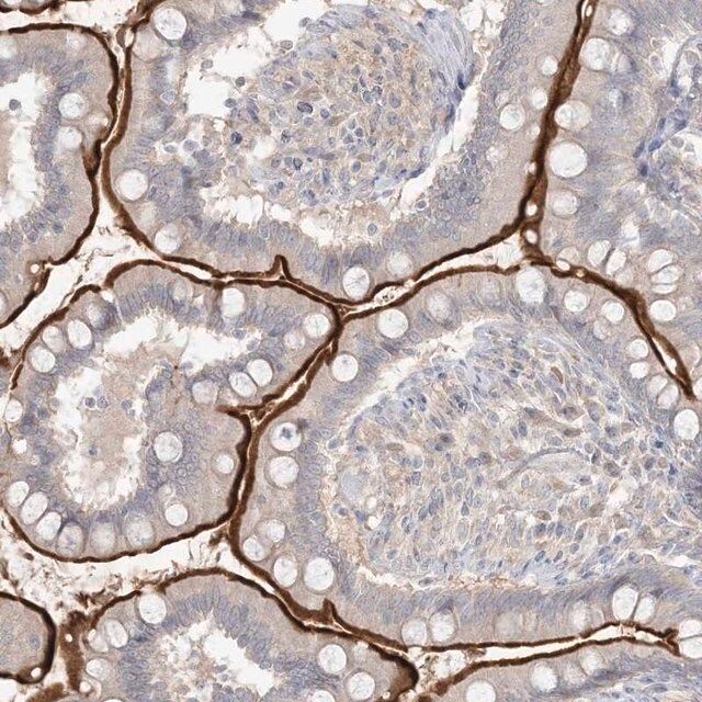 Anti-SH3BP4 antibody produced in rabbit