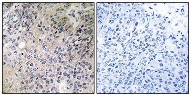 Anti-SHC3 antibody produced in rabbit