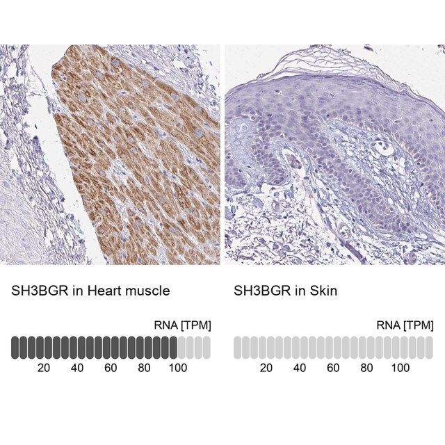 Anti-SH3BGR antibody produced in rabbit