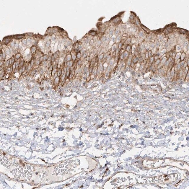 Anti-SH3BP2 antibody produced in rabbit