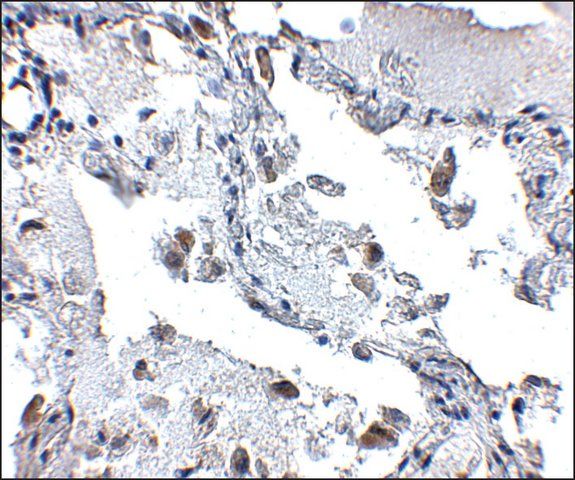 Anti-SH3BP4 antibody produced in rabbit