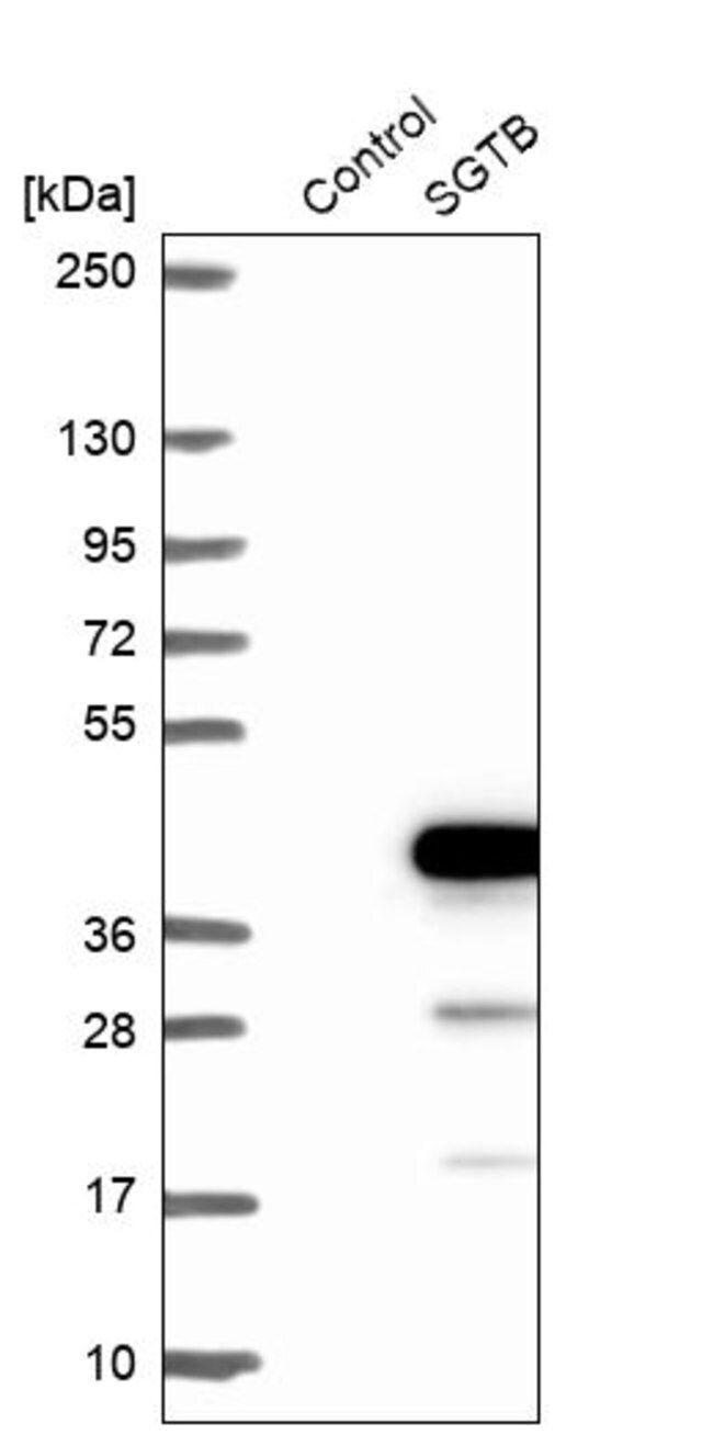 Anti-SGTB antibody produced in rabbit