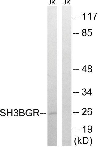 Anti-SH3BGR antibody produced in rabbit