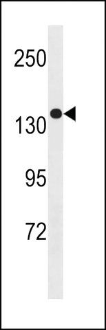 ANTI-SGSM1 (CENTER) antibody produced in rabbit