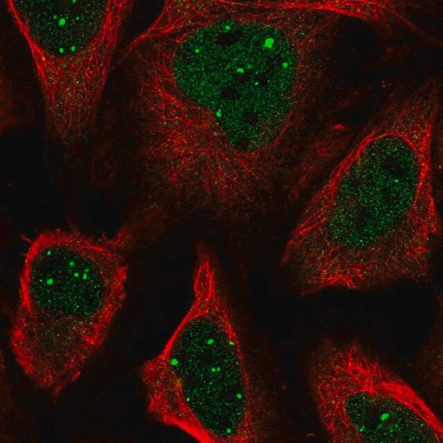 Anti-SH3BP5 antibody produced in rabbit