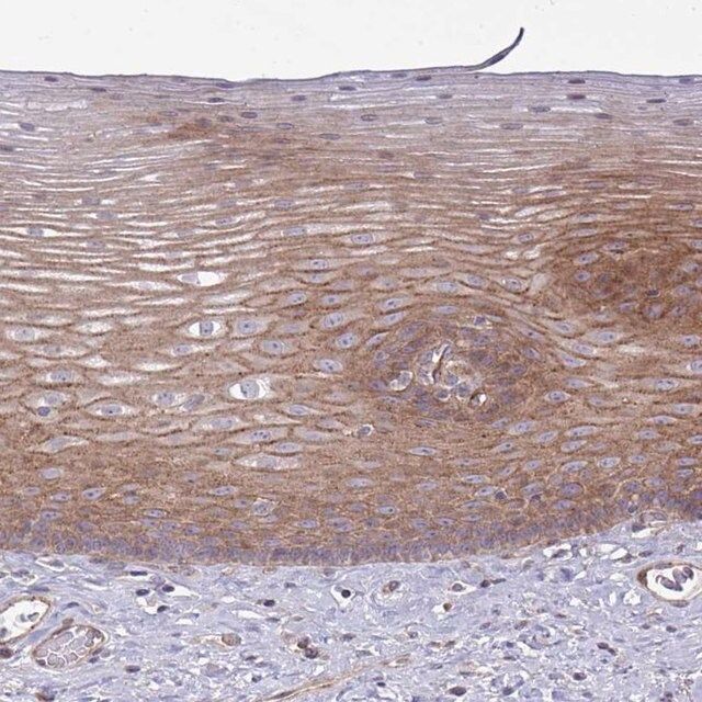 Anti-SH2D1B antibody produced in rabbit