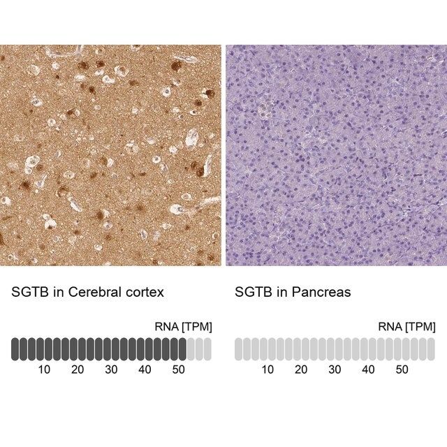 Anti-SGTB antibody produced in rabbit