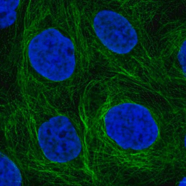 Anti-SH2D3A antibody produced in rabbit