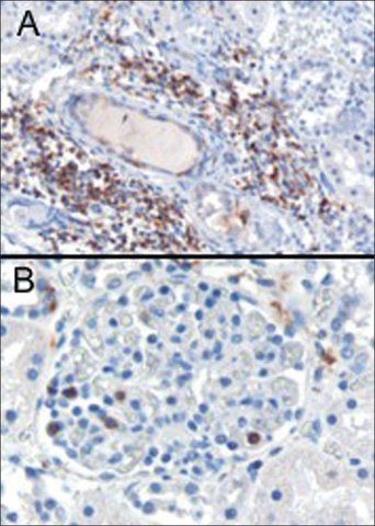 Anti-SH3BP1 antibody produced in goat