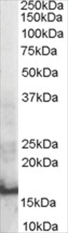 Anti-SH2D1A/SAP antibody produced in goat