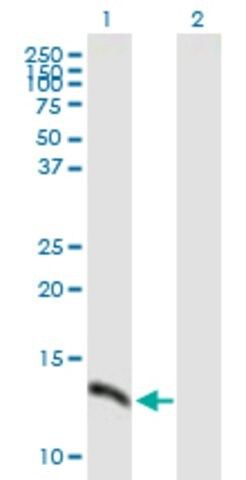 Anti-SH2D1A antibody produced in mouse