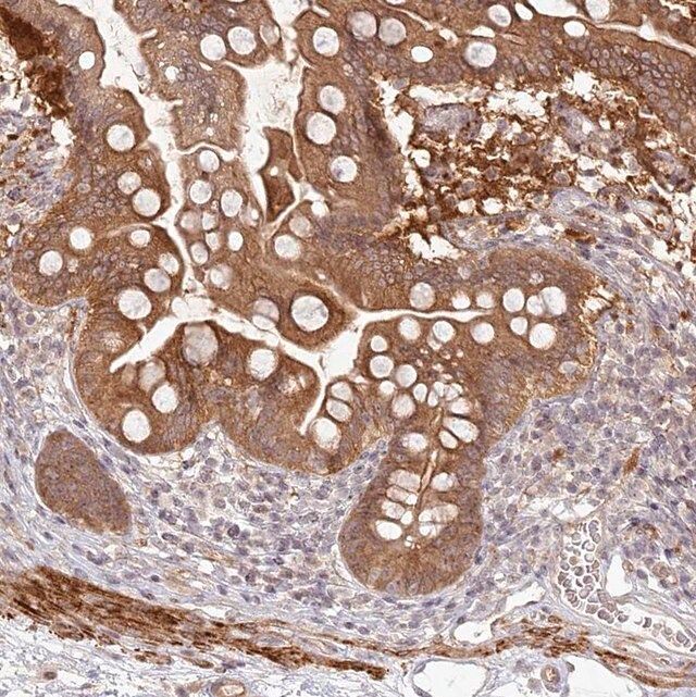 Anti-SH2D3A antibody produced in rabbit