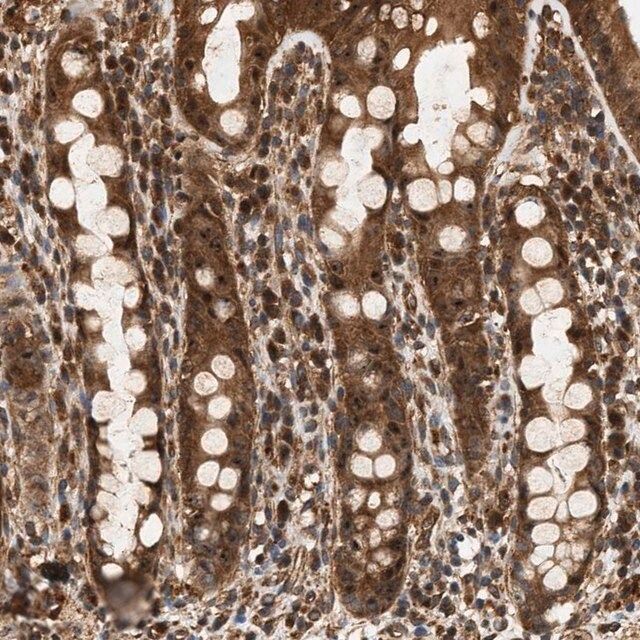 Anti-SH3GLB2 antibody produced in rabbit