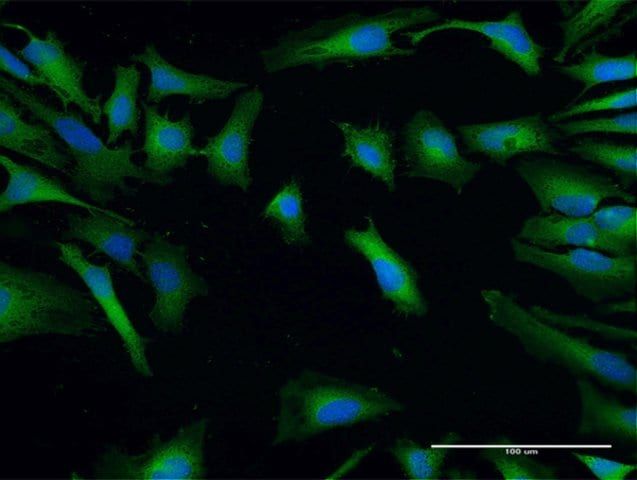 Anti-SH3GLB2 antibody produced in mouse