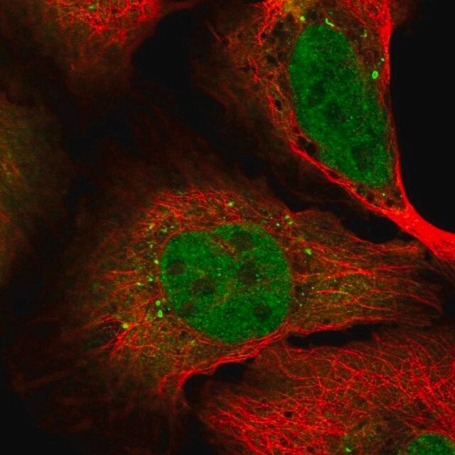 Anti-SHISA2 antibody produced in rabbit