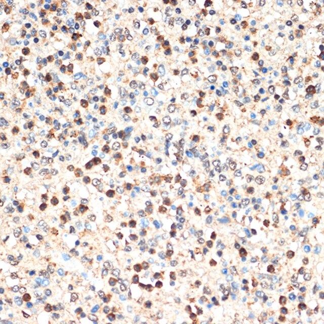 Anti-SHIP1 antibody produced in rabbit