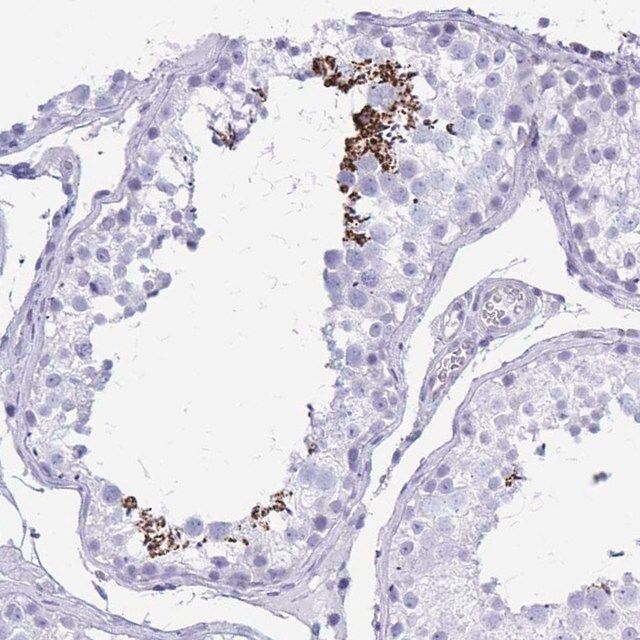 Anti-SHISA8 antibody produced in rabbit