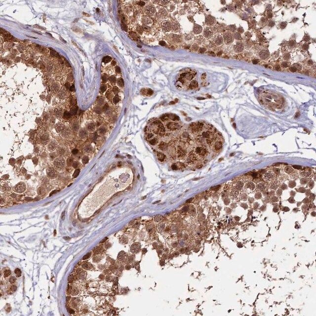 Anti-SHPRH antibody produced in rabbit