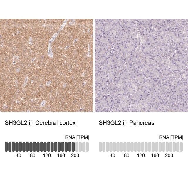 Anti-SH3GL2 antibody produced in rabbit