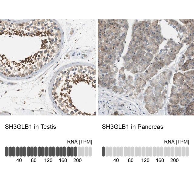 Anti-SH3GLB1 antibody produced in rabbit