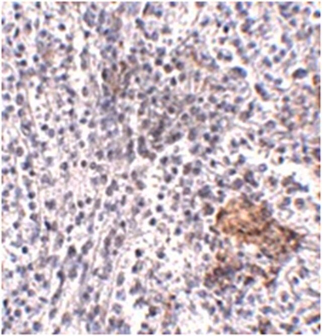 Anti-SHOC2 Antibody