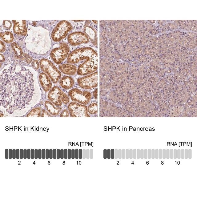 Anti-SHPK antibody produced in rabbit