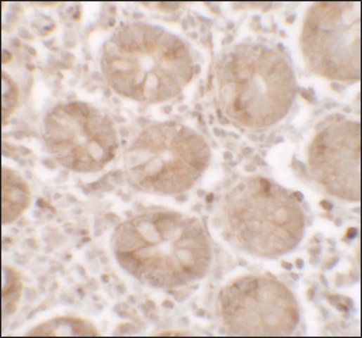 Anti-SHISA3 antibody produced in rabbit