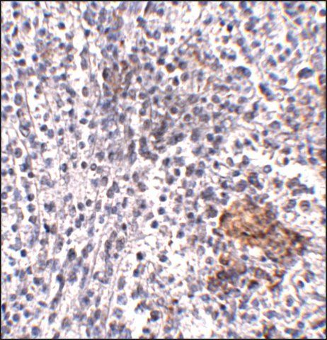 Anti-SHOC2 antibody produced in rabbit