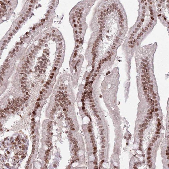 Anti-SH3RF3 antibody produced in rabbit