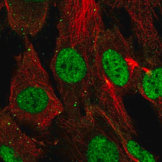 Anti-SHOX antibody produced in rabbit