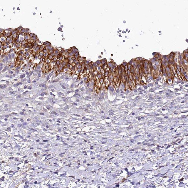 Anti-SH3TC2 antibody produced in rabbit