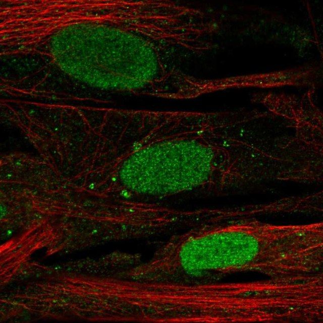 Anti-SHOX antibody produced in rabbit