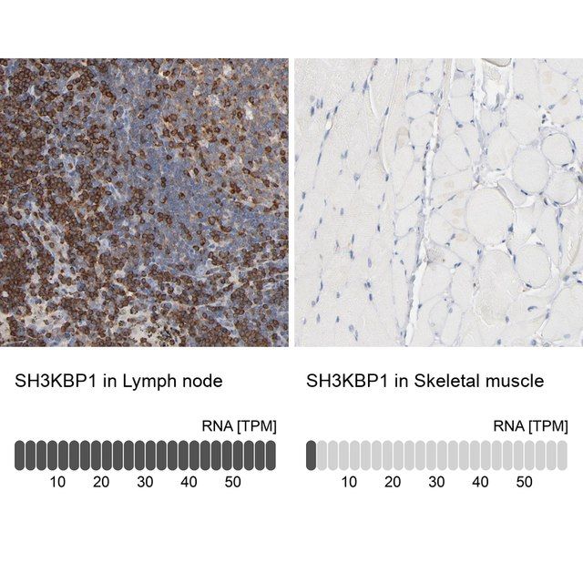 Anti-SH3KBP1 antibody produced in rabbit