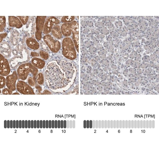 Anti-SHPK antibody produced in rabbit