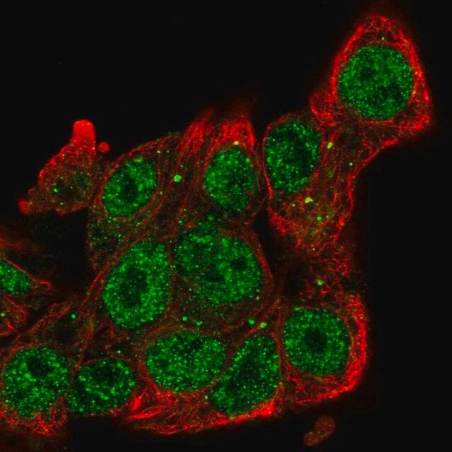 Anti-SIAH2 antibody produced in rabbit