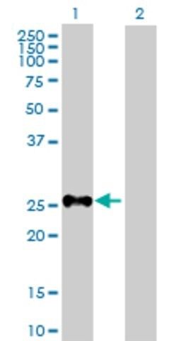 Anti-SHOX antibody produced in mouse