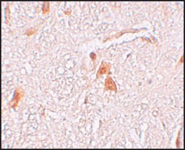 Anti-SHISA9 antibody produced in rabbit