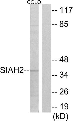 Anti-SIAH2, antibody produced in rabbit