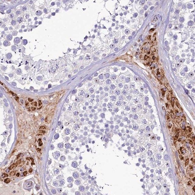 Anti-SH3TC2 antibody produced in rabbit