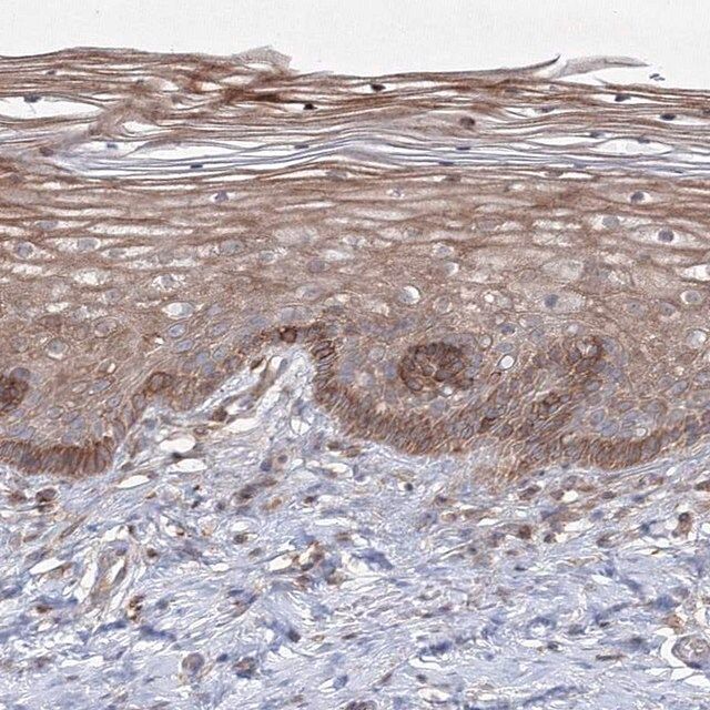 Anti-SH3PXD2A antibody produced in rabbit