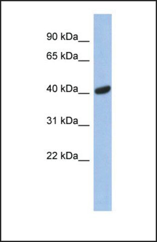 Anti-SIAH2 antibody produced in rabbit