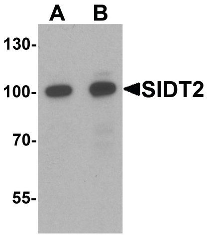 Anti-SIDT2 antibody produced in rabbit