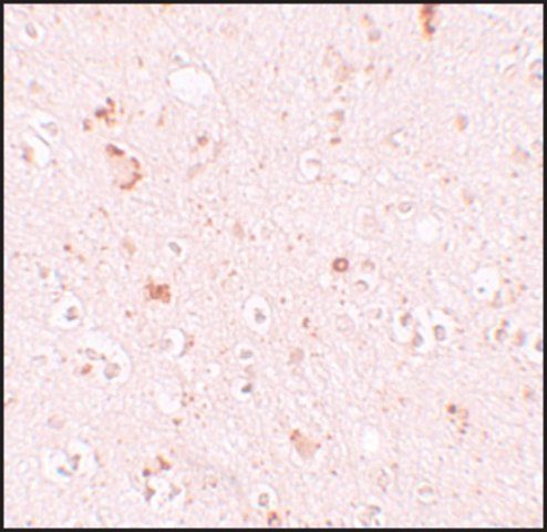 Anti-SH3RF2 antibody produced in rabbit